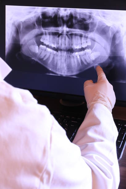 Best Emergency Dental Care for Broken or Chipped Teeth in Cedar Creek, TX